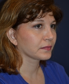 After Image