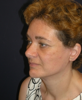 After Image