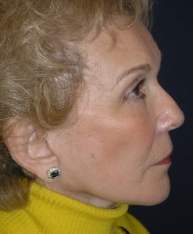 After Image