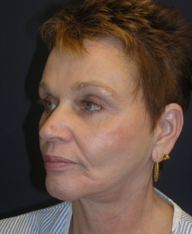 After Image