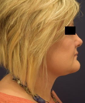 After Image