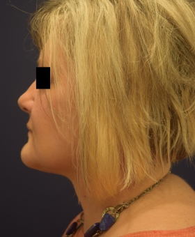 After Image