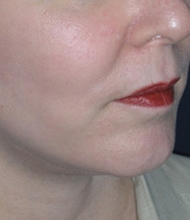 After Image
