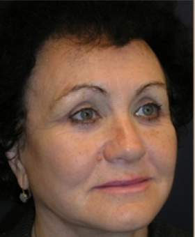 After Image