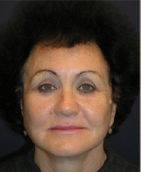 After Image