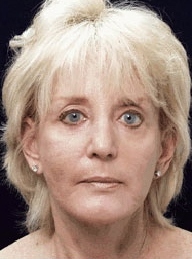 After Image
