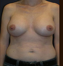 After Image
