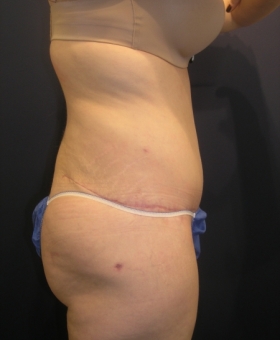 After Image