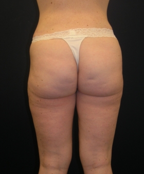 After Image