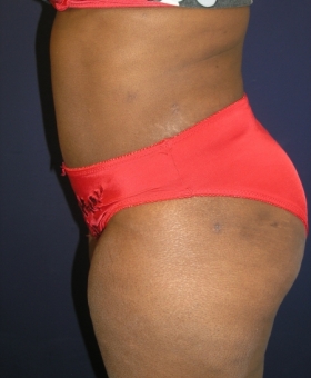 After Image
