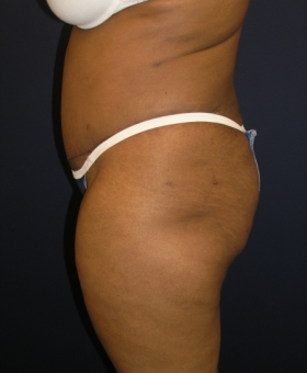 After Image