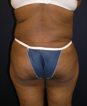 After Image