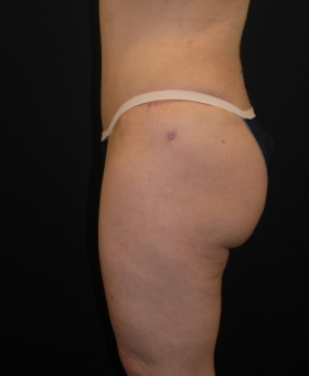 After Image