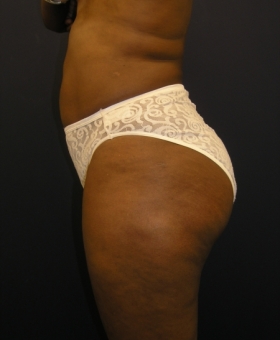 After Image