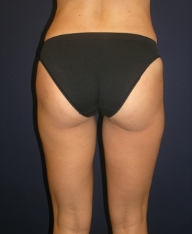 After Image