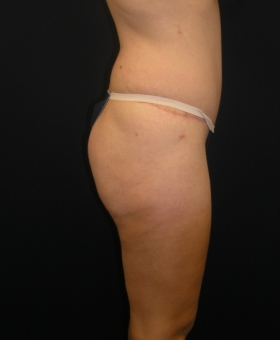 After Image