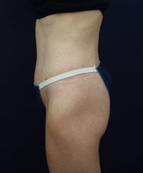 After Image
