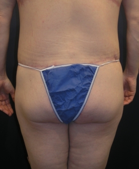 After Image