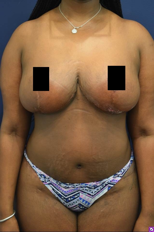 After Image