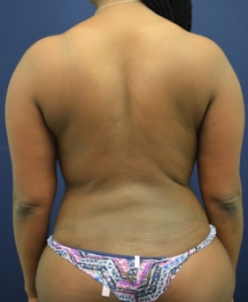 After Image
