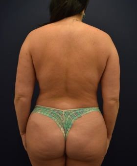 After Image