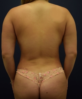 After Image
