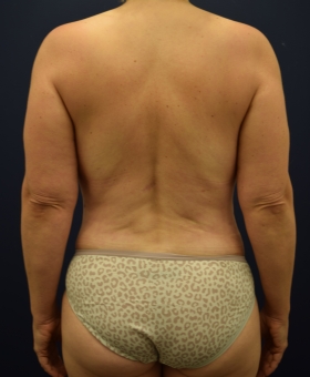 After Image