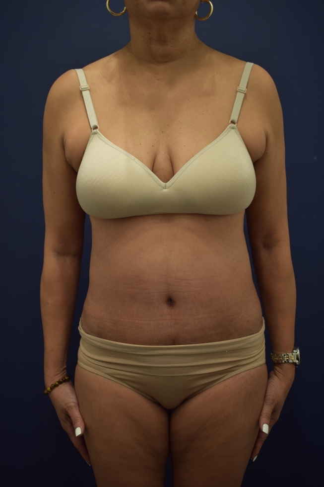 After Image