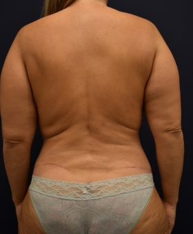After Image
