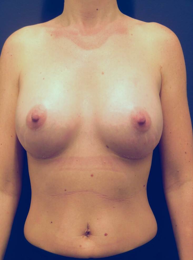 After Image