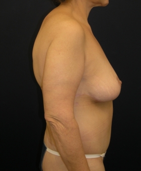 After Image