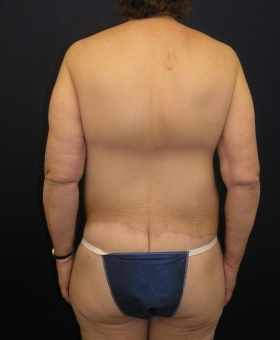 After Image