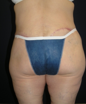 After Image