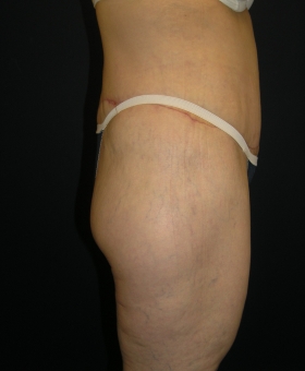 After Image