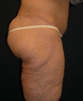 After Image