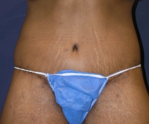 After Image