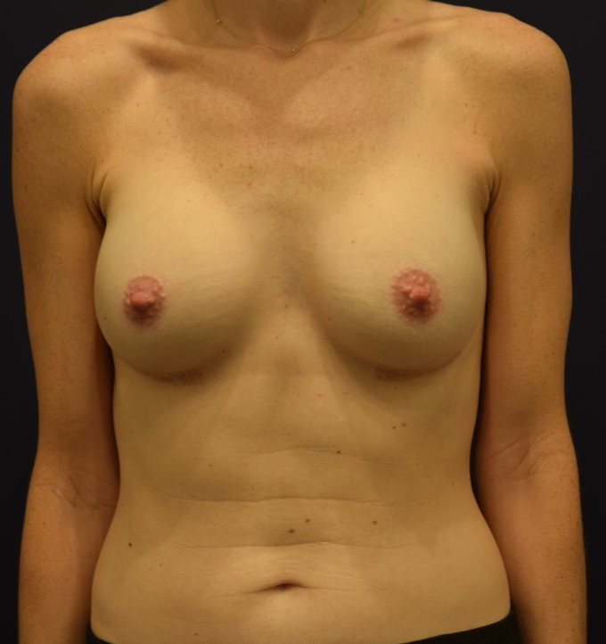 After Image