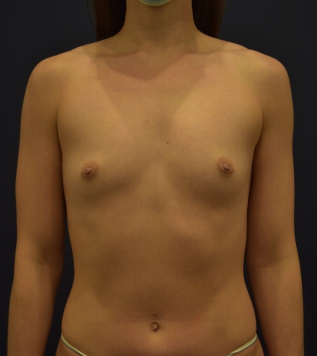 Before Image
