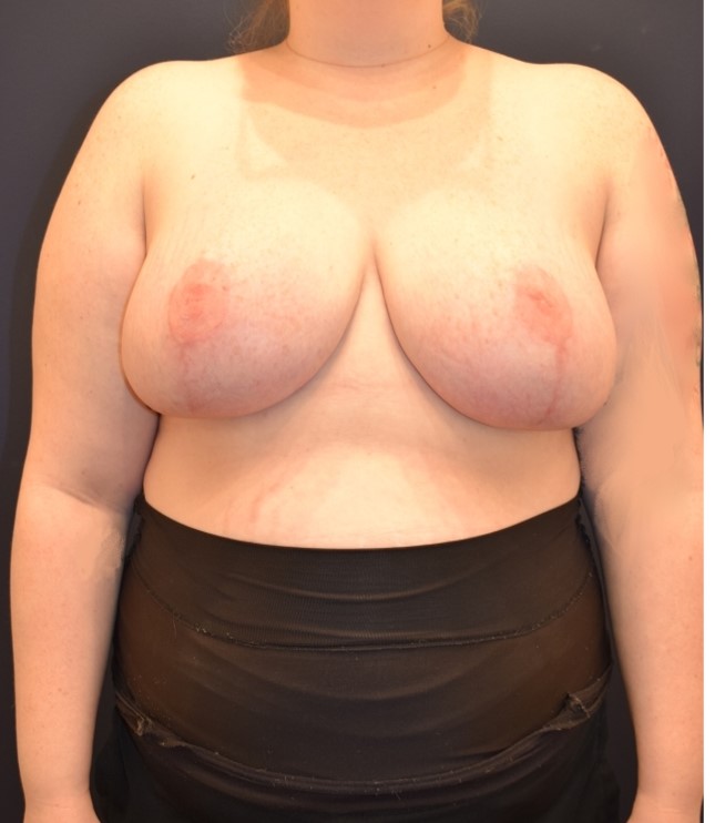 After Image