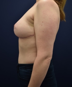 After Image