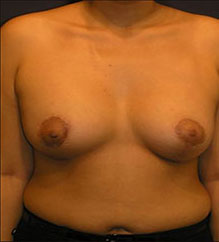 After Image