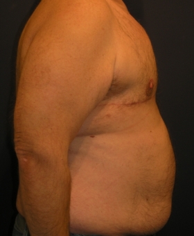 After Image
