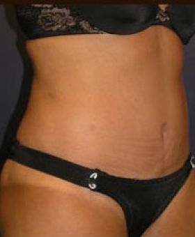 After Image