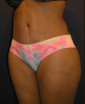 After Image