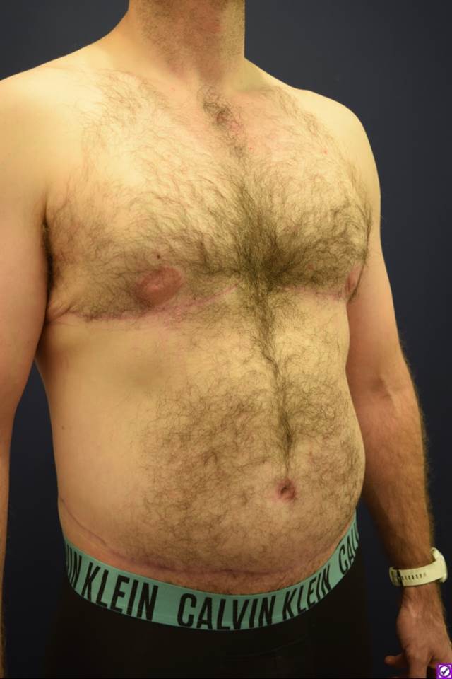 After Image