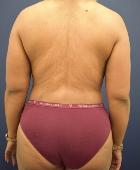 After Image