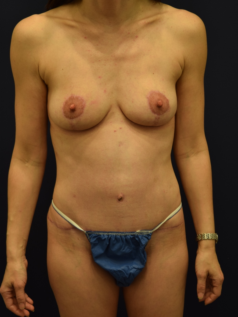 After Image
