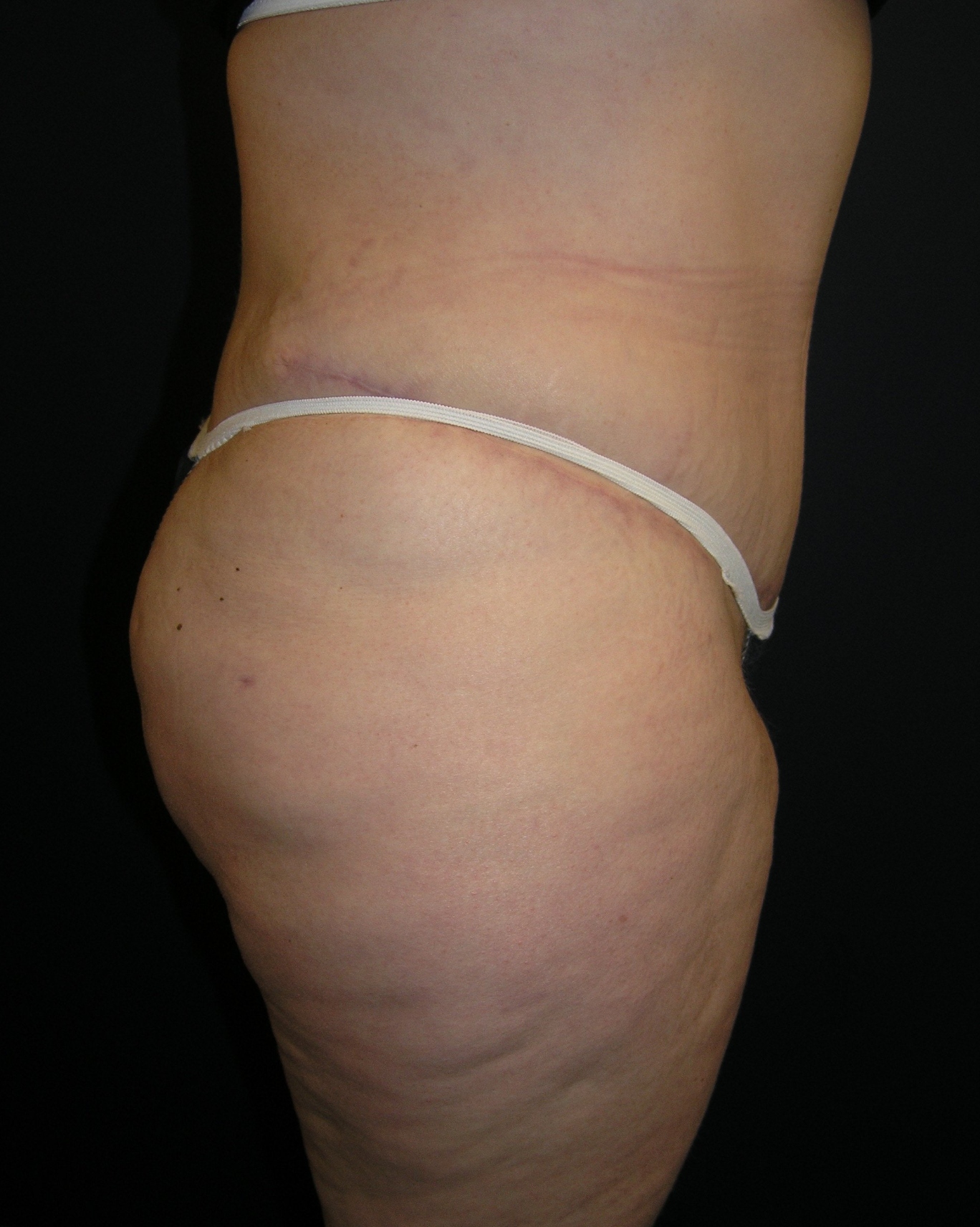 After Image