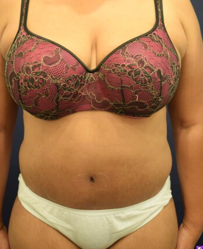 After Image