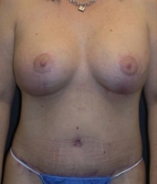 After Image